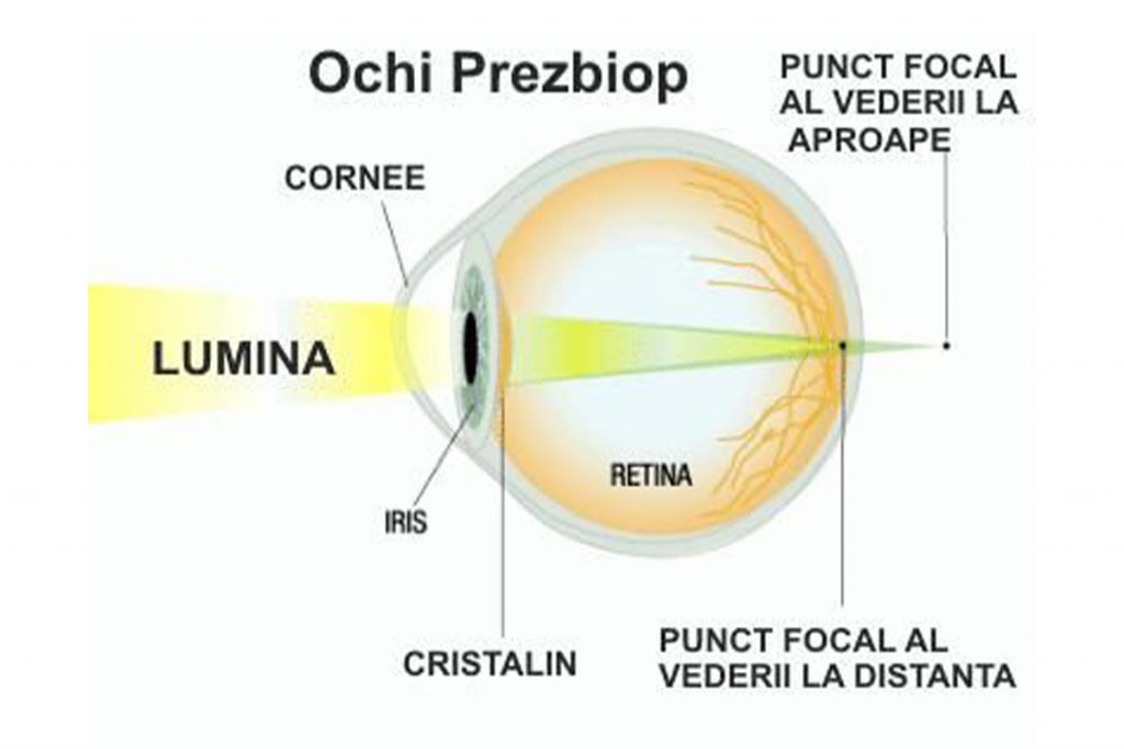 B187 - Ce este prezbiopia și cum o putem combate_1